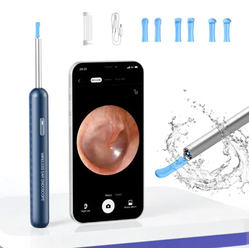 Visual Earpick Endoscope Smart Ear Picking Tools WiFi WEM Support (www.WEM.support)