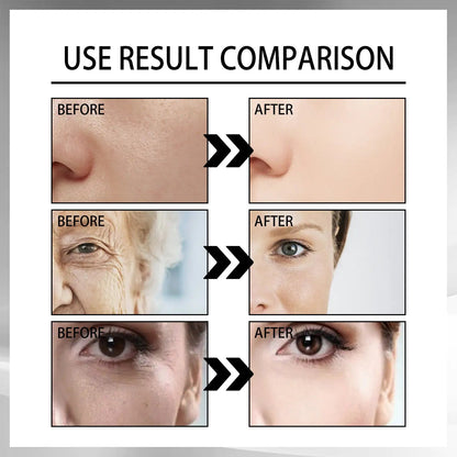 Snail Cream Fading Wrinkle French Lines Replenishment Firming Skin Anti-Aging WEM Support (www.WEM.support)