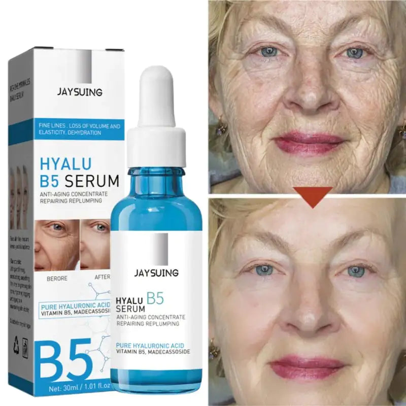 B5 Hyaluronic Acid Serum WEM Support (www.WEM.support)
