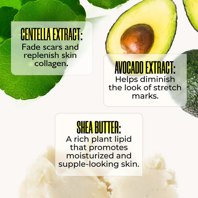 Stretch Mark Removal Cream WEM Support (www.WEM.support)