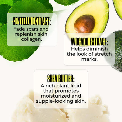 Stretch Mark Removal Cream WEM Support (www.WEM.support)