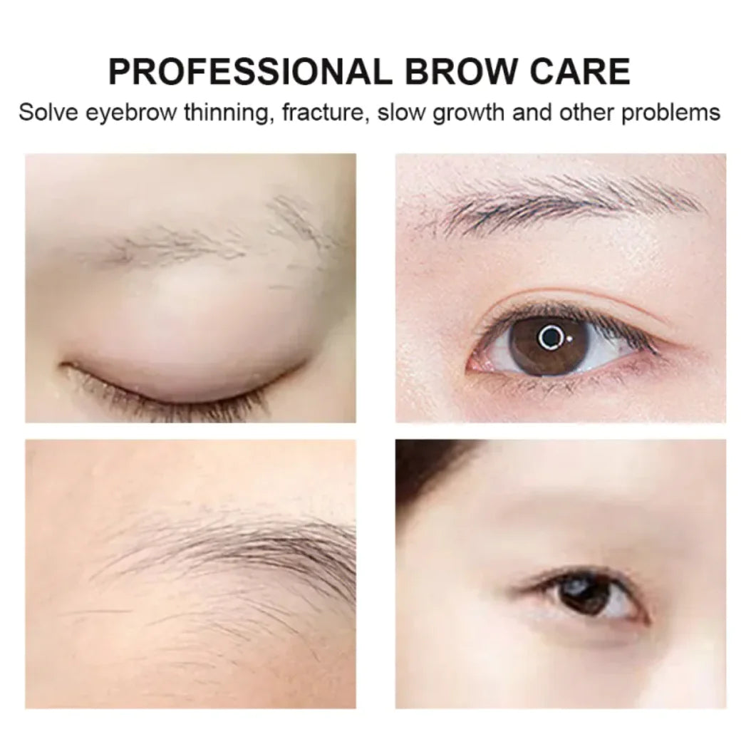 Eyebrow Growth Essential Oil WEM Support (www.WEM.support)