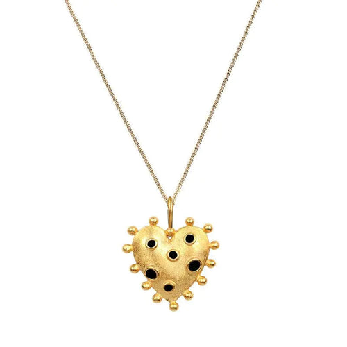 Bumpy Necklace WEM Support (www.WEM.support)