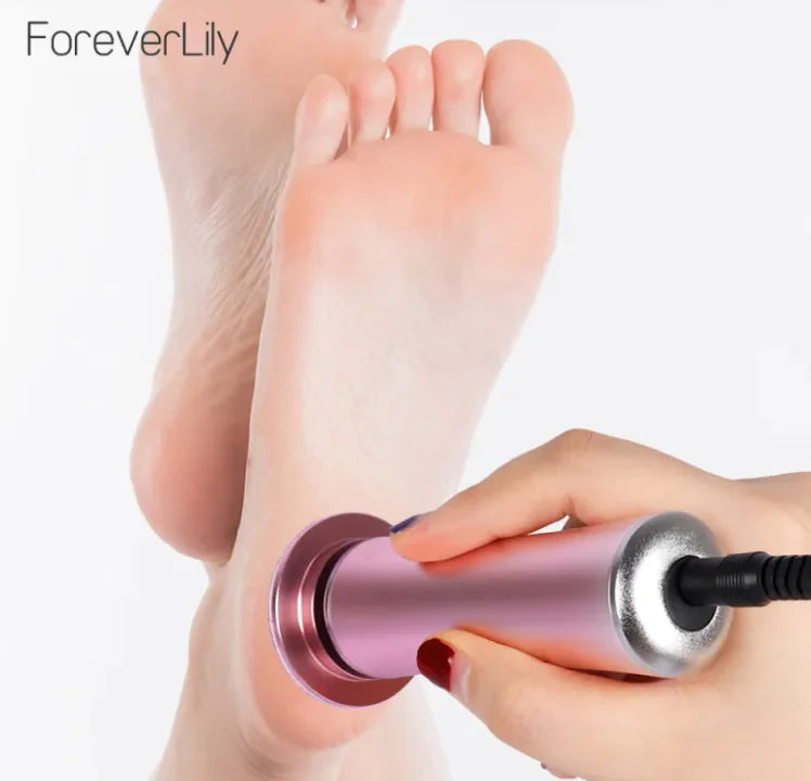 Electric Foot Callus Remover WEM Support (www.WEM.support)