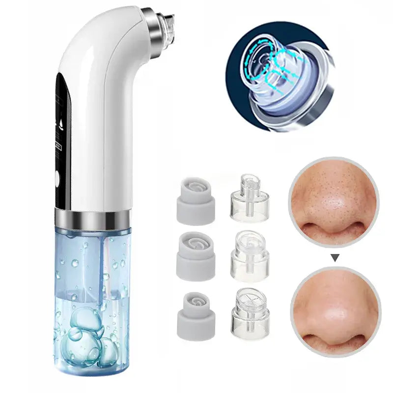 Blackhead Remover Pore Vacuum WEM Support (www.WEM.support)