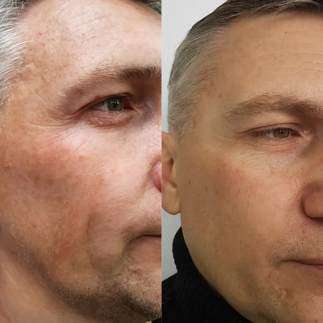 Anti-Aging HIFU, EMS and Microcurrent WEM Support (www.WEM.support)