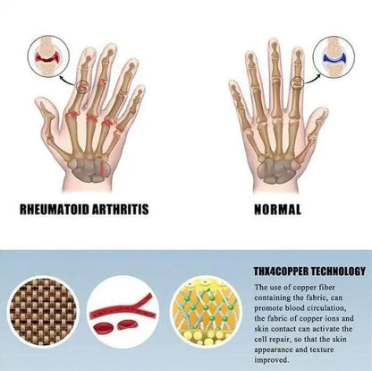 Arthritis-Kompressionshandschuhe WEM Support (www.WEM.support)