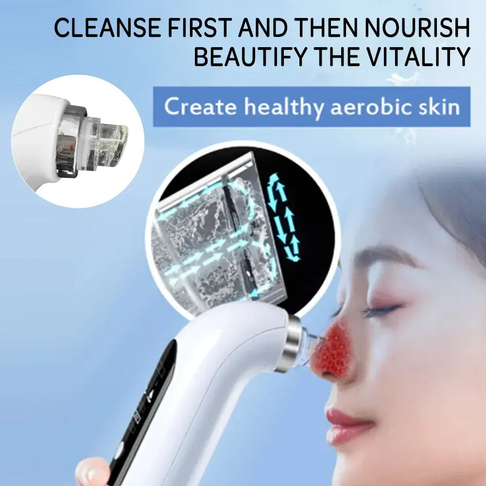 Blackhead Remover Pore Vacuum WEM Support (www.WEM.support)