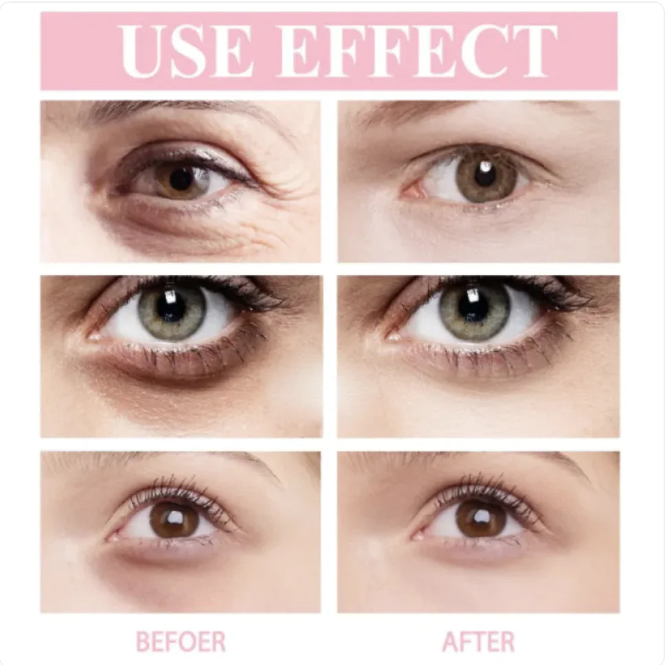 Retinol Eye Cream Stick WEM Support (www.WEM.support)