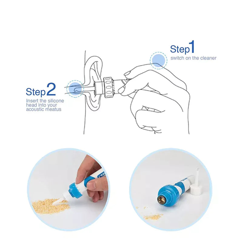 Safety Electric Cordless Vacuum Ear Cleaner Wax Remover Painless Cleaning Tool WEM Support (www.WEM.support)