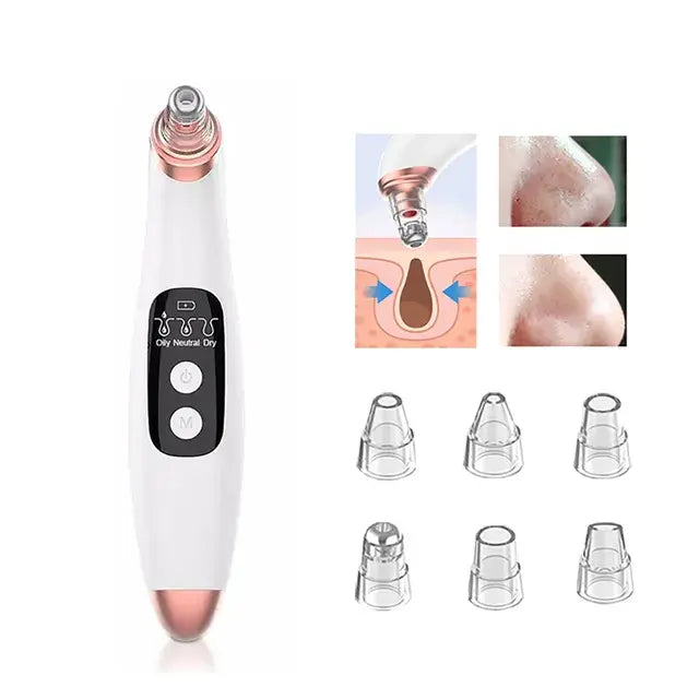 Blackhead Remover Pore Vacuum WEM Support (www.WEM.support)