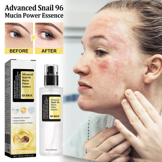Snail Serum Collagen Facial Serum Original WEM Support (www.WEM.support)