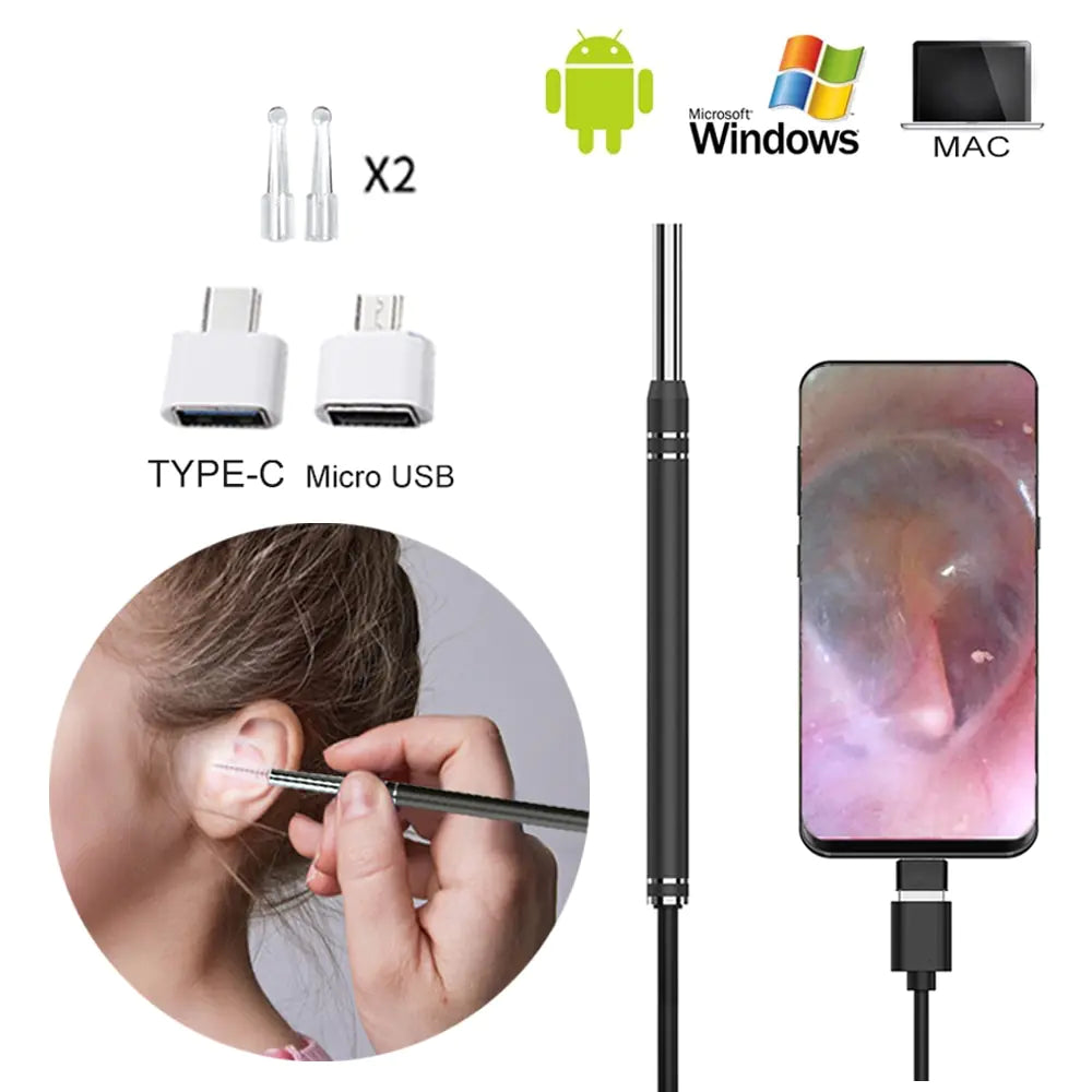 Smart Earwax Removal Tool w/ Camera WEM Support (www.WEM.support)