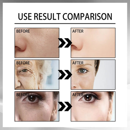 Creativity Snail Mucin Set WEM Support (www.WEM.support)