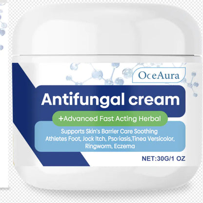 Soothing Natural Anti-fungal Cream WEM Support (www.WEM.support)