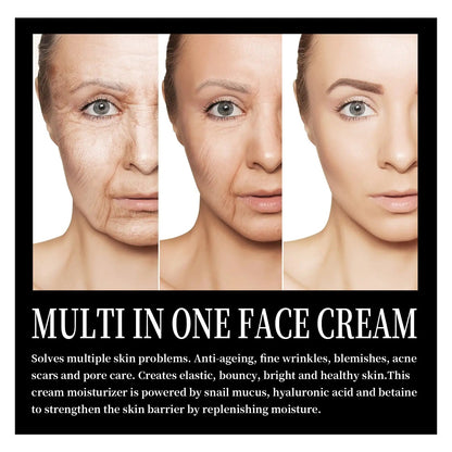 Snail Cream Fading Wrinkle French Lines Replenishment Firming Skin Anti-Aging WEM Support (www.WEM.support)